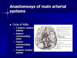 The blood vessel can become twisted in several different parts of the body, including the main artery of neck. Stroke Stroke N N N Second Important Cause