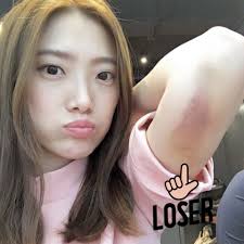 Polly So : 即時瘦到嘅HiFu分享| CLINICZ水原共生| 明星紅人星級見證CLINICZ