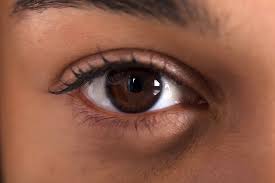Yeux Gonfles Cernes Rougeur Et Sensation De Brulure Oculaires