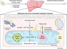 Paediatric Fatty Liver Disease Pefld All Is Not Nafld Pathophysiological Insights And Approach To Management Journal Of Hepatology