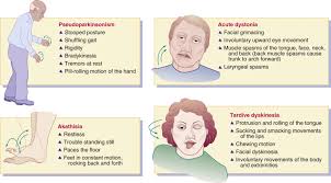 We did not find results for: Antipsychotics And Anxiolytics Basicmedical Key