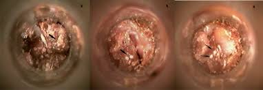 Image result for what do otodectes cynotis look like in dog fur