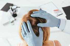 Other forms can be treated successfully by a dermatologist. Hair Loss And Scalp Disorders Brisbane Skin Partners Brisbane Dermatologist Hair Loss Specialist Brisbane General Surgical Laser Dermatology