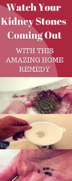 Watch Your Kidney Stones Coming Out With This Amazing Home Remedy Home Remedies Remedies Kidney Stones