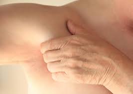 An early sign of inflammatory breast cancer is discoloration of the breast. 8 Signs And Symptoms Of Breast Cancer Besides A Lump