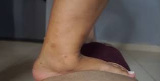 Bbw stomach trample 4 - ThisVid.com