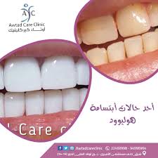 الآن اجعلي ابتسامتك مشرقة مع عروض أوتاد كير كلينيك سارعى بالحجز الآن أوتاد كير كلينيك 22460998 94996964 Convenience Store Products Convenience Store Store