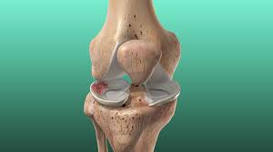 They also help to stabilise your knee joint and keep the. Torn Meniscus Johns Hopkins Medicine