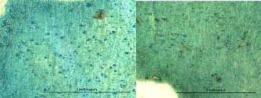 We offer pest control massachusetts exterminating companies, pest control: Tracing The Alteration Of Verdigris Pigment Through Combined Raman Spectroscopy And X Ray Diffraction Part Ii Natural Ageing In Restaurator International Journal For The Preservation Of Library And Archival Material Volume 41 Issue