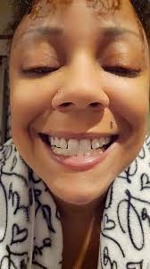 Do others have button spots