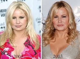 Jennifer Coolidge Plastic Surgery Before After Jennifer Coolidge Lip Augmentation Plastic Surgery