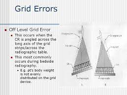 Radiographic Grids Abstract Grids Are Devices That Are