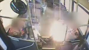 Find out how and why e cig batteries explode. This Teen S Vape Exploded Shattering His Jaw Cnn