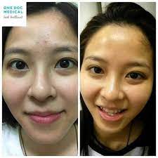 They utilise their signature 4 steps program to promote hair growth for both men and women. Facebook