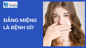 Mồm đắng miệng là bệnh gì? Cảnh báo 6 bệnh phổ biến nhất