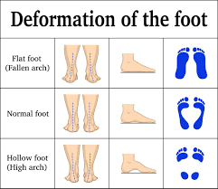 You can massage your foot to help stimulate the nerves and muscles while improving circulation. Foot Pain In The Morning