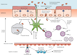 Ulcerative Colitis The Lancet