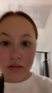 The Lady That Died from Wrasp Nest in Her Hair