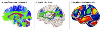 Blue brain project reconstructing the brain piece by. The Human Brain Connectome Current Human Brain Maps Of Anatomical Download Scientific Diagram