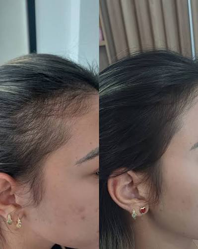 Cascavel Ordinária | O Salão Meninas Vip (@meninasvip_cabeleireiras) vem se  consolidando como referência em Cascavel e região ao oferecer terapia  capilar para... | Instagram