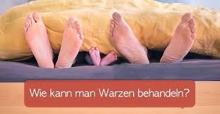 Meistens sind sie leicht erhaben oder flach. Warzen Entfernen Vereisen Besprechen Oder Hausmittel