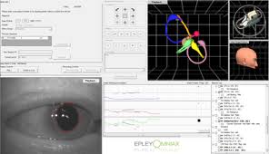 James epley for congress, greenville, south carolina. Epley Omniax System Trinity Hearing Balance Trinity Fl