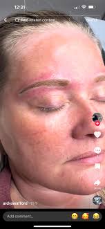 On Nov 9th I had a powder brow done here in Jackson. This gentleman was  recommended so I paid $400 for the service. Once the scabbing fell off not  a shadow of