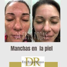 Dr. Eric Rojas Blanco