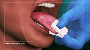 The characteristics of these lumps include: Oral Cancer Screenings Dentist Seattle Wa Queen Anne Family Dental