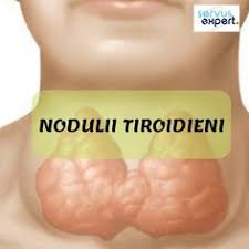 Tumefieri ale glandei tiroide, nodulii tiroidieni sunt cea mai frecventa afectiune a sistemului endocrin, afectand atat barbatii cat si femeile. 36 Tiroida Ideas Sistemul Endocrin SÄƒnÄƒtate Sfaturi Pentru SÄƒnÄƒtate