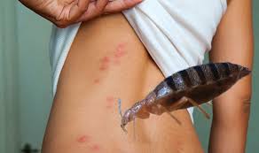 The most obvious sign of bed bugs is, of course, the presence of bed bugs themselves. Bed Bugs Four Signs Of An Infestation To Watch Out For Express Co Uk