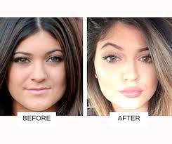 Kylie jenner is a reality tv star, a model, and a businesswoman. Kylie Jenner Plastic Surgery Before And After Images 2021