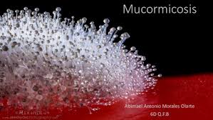 Zigomicosis (mucormicosis) cutánea en paciente con leucemia. Ppt Mucormicosis Abimael Olarte Academia Edu