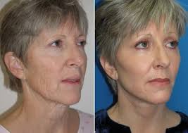 Featured Makeovers 1 Richmond VA