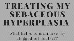 Our educational content is not meant or intended for medical advice or treatment. How I Treat My Sebaceous Hyperplasia Ways To Minimize My Clogged Oil Ducts Youtube