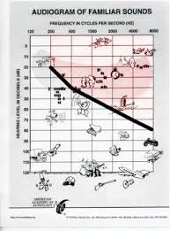 The Best Hearing Loss Simulations Understanding Audiograms