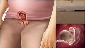 Vaginitis tanda dan gejala penyebab cara obat keputihan saat hamil 5 bulan hamil obat alami wanita. Contoh Keputihan Tanda Hamil 1 Minggu Dan Ciri Ciri Tanda Awal Kehamilan Blog Keluarga