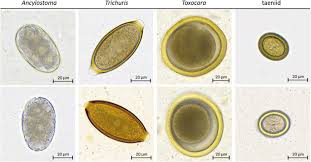 But others can suffer dermatitis from being allergic to flea bites and they can even get secondary infections, as. Evaluation Of The Vetscan Imagyst An In Clinic Canine And Feline Fecal Parasite Detection System Integrated With A Deep Learning Algorithm Parasites Vectors Full Text