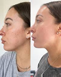 Vanessa Cichon, ACNPC-AG, FNP