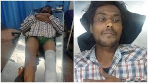 Haryana:पुलिस मुठभेड़ में धरा गया आरोपी, लूट मामले में था वांछित; गुप्त  सूचना पर की कार्रवाई - One Accused Arrested In Robbery Case - Amar Ujala  Hindi News Live