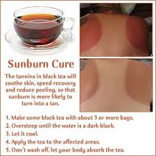 Sunburn Hacks Natural Remedies For Peeling Burnt Skin Diy Methods Cure For Sunburn Sunburn Remedies How To Treat Sunburn