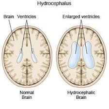 Pin On Mayas Fabulous Future Of A Neurosurgeon