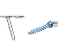 Matrix Mandible System