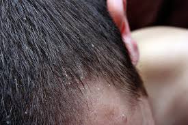 Cloudlinux s drived from sources freely provided to the public by a prominent north american enterprise linux vendor. Fish Oil For Hair Growth Effects Benefits Hairguard
