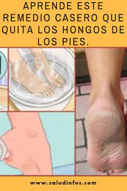 El extracto de azadirachta indica, es capaz de eliminar los principales agentes patógenos y dermatofitos de la usa zapatos que permitan que el aire circule libremente alrededor de tus pies. Pin On Cuidado De Los Pies