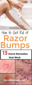 How To Get Rid Of Razor Bumps Fast With 13 Home Remedies That Work