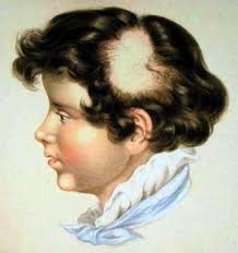 Mole Hill Topics: Dr Paul Farrant, Consultant Dermatologist & Clinical Lead  at BSUH