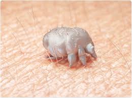 Image result for scabies transmission