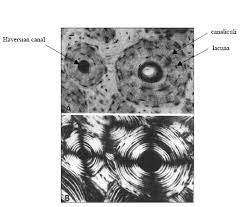 Cross sections of the bone when studied under the microscope reveal quite a different picture. A Histological Cross Section Of Cortical Bone Showing Osteon With Download Scientific Diagram