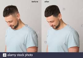 Hair loss treatment for men. Hair Rescuer
